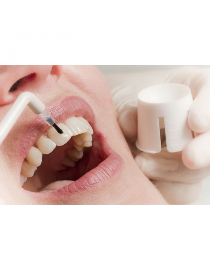 Ταπετσαρία για ιατρικό χώρο Λεύκανση δοντιών